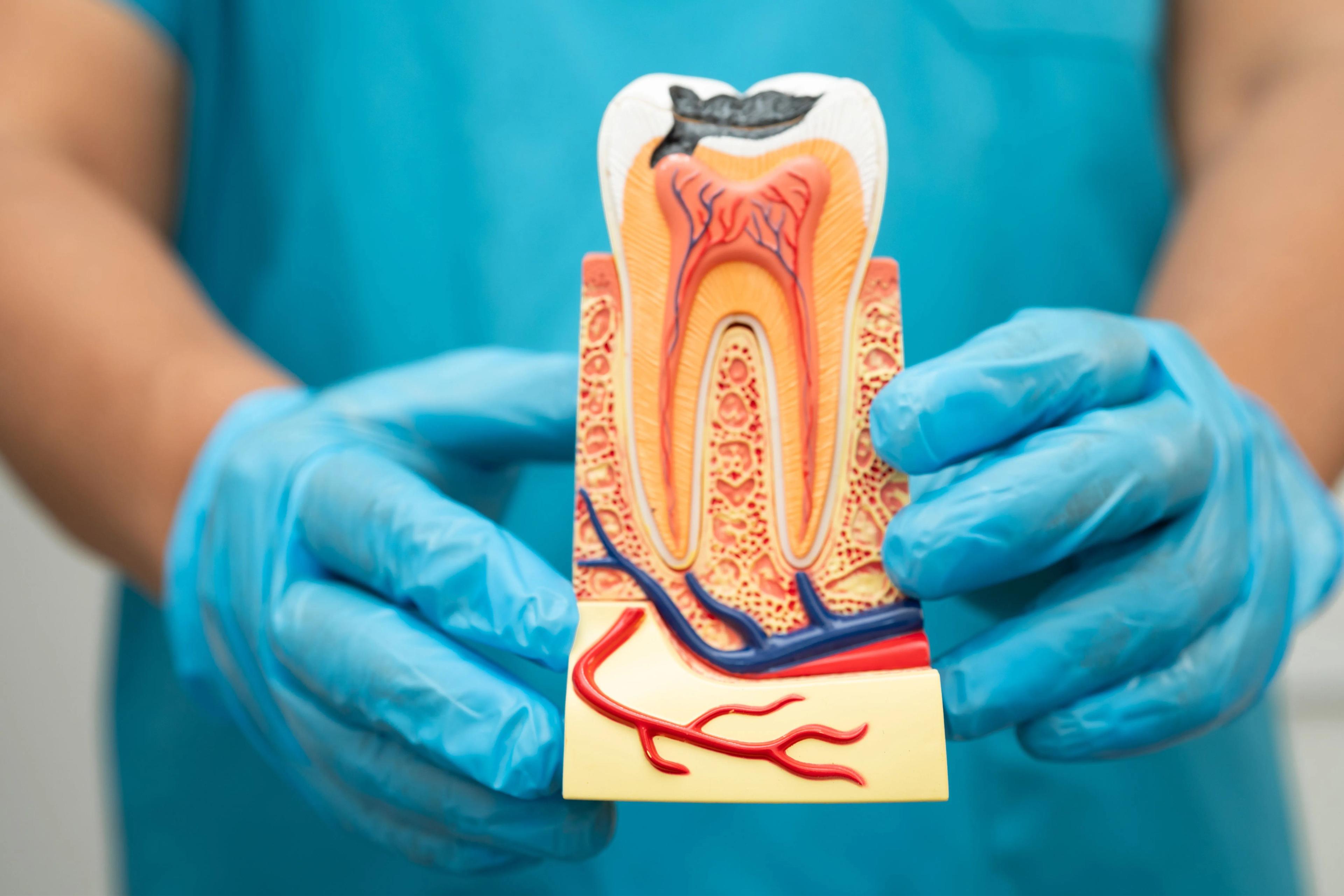 How Many Visits Does a Root Canal Usually Take, and Why?